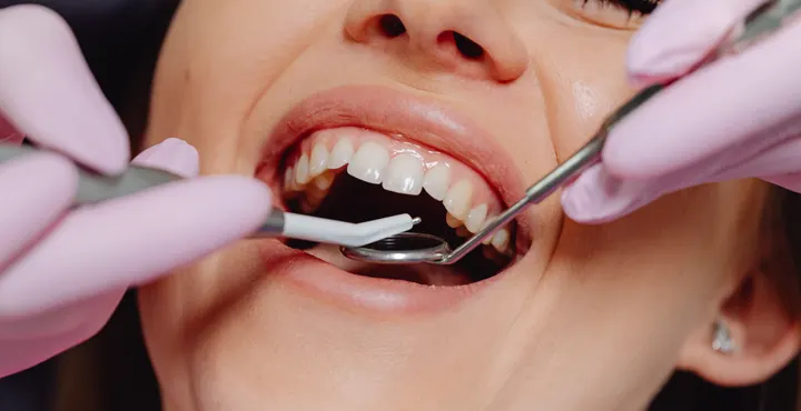Dentes antes do tratamento odontológico