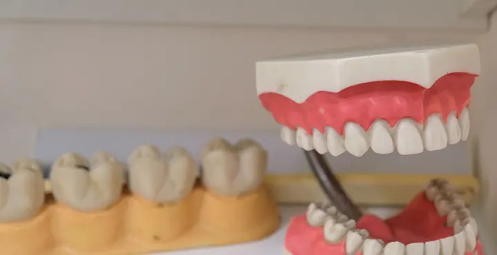 Simulação do arco dentário com alinhamento planejado